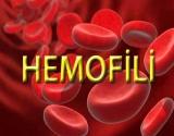 Hemofili Hakkında Bilgi